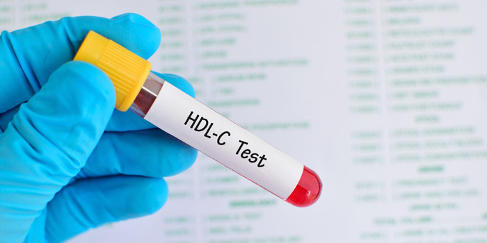 El colesterol HDL pierde poder cardioprotector en hipercolesterolemia familiar